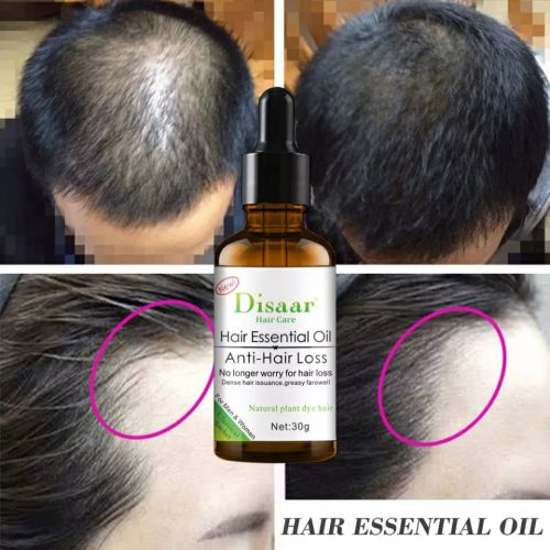 ✅Disaar essential oil anti hair loss